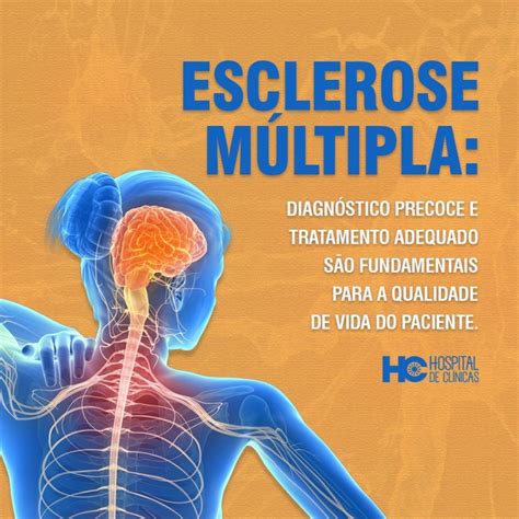 tratamento de esclerose multipla|como saber si tengo esclerosis multiple.